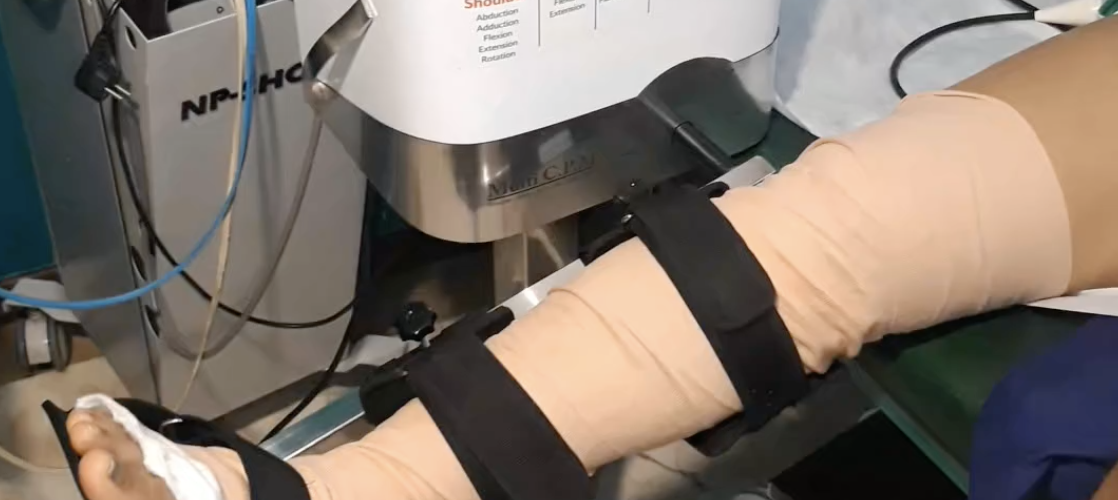 دستگاه Multi CPM : کاربرد، مزایا و افزایش دامنه حرکتی مفاصل